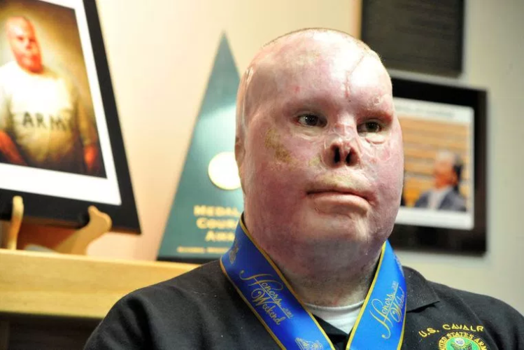 Screen Shot 2017-11-17 at 10.18.13 AM